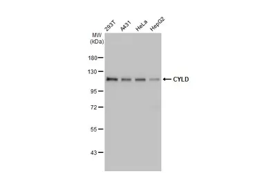 Anti-CYLD antibody used in Western Blot (WB). GTX100228