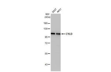 Anti-CYLD antibody used in Western Blot (WB). GTX100228