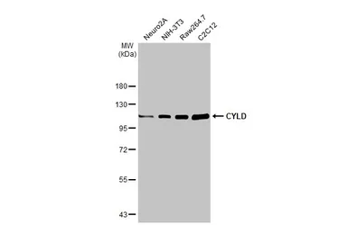 Anti-CYLD antibody used in Western Blot (WB). GTX100228