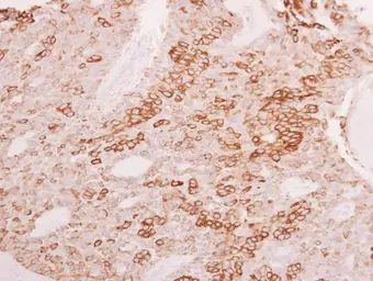 Anti-ESE1 antibody [C2C3], C-term used in IHC (Paraffin sections) (IHC-P). GTX100250