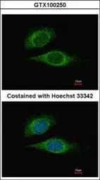 Anti-ESE1 antibody [C2C3], C-term used in Immunocytochemistry/ Immunofluorescence (ICC/IF). GTX100250
