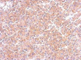 Anti-EML1 antibody [C3], C-term used in IHC (Paraffin sections) (IHC-P). GTX100252