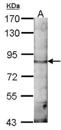 Anti-EML1 antibody [C3], C-term used in Western Blot (WB). GTX100252