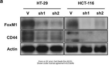 Anti-FOXM1 antibody [C3], C-term used in Western Blot (WB). GTX100276