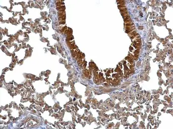Anti-14-3-3 sigma antibody used in IHC (Paraffin sections) (IHC-P). GTX100289