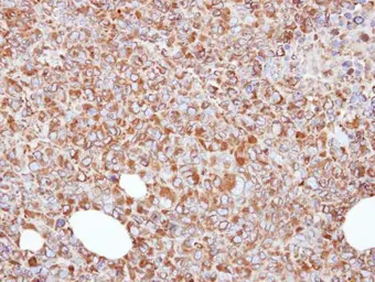 Anti-ERp57 antibody [C3], C-term used in IHC (Paraffin sections) (IHC-P). GTX100297