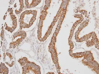 Anti-ERAB antibody used in IHC (Paraffin sections) (IHC-P). GTX100301