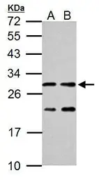 Anti-ERAB antibody used in Western Blot (WB). GTX100301
