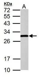 Anti-ERAB antibody used in Western Blot (WB). GTX100301