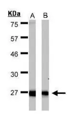 Anti-ERAB antibody used in Western Blot (WB). GTX100301