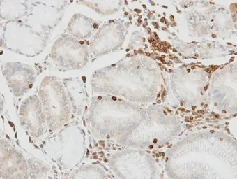 Anti-HCLS1 antibody [C3], C-term used in IHC (Paraffin sections) (IHC-P). GTX100303
