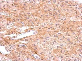 Anti-Dopamine Receptor D1 antibody [C2C3], C-term used in IHC (Paraffin sections) (IHC-P). GTX100354