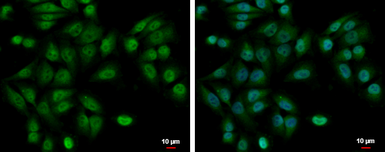 Anti-UBE2A antibody used in Immunocytochemistry/ Immunofluorescence (ICC/IF). GTX100426