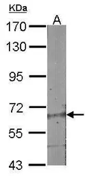 Anti-ABCG2 antibody used in Western Blot (WB). GTX100437
