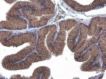 Anti-E-Cadherin antibody used in IHC (Paraffin sections) (IHC-P). GTX100443