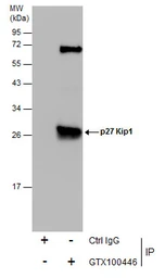 Anti-p27 Kip1 antibody used in Immunoprecipitation (IP). GTX100446