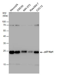 Anti-p27 Kip1 antibody used in Western Blot (WB). GTX100446