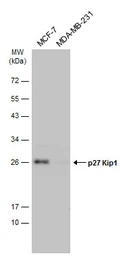 Anti-p27 Kip1 antibody used in Western Blot (WB). GTX100446