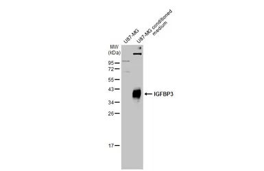 Anti-IGFBP3 antibody [N2C3] used in Western Blot (WB). GTX100454