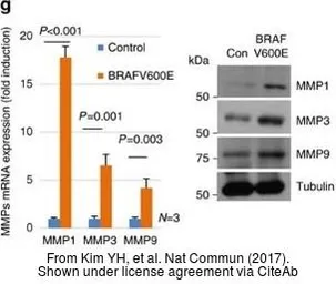 Anti-MMP9 antibody [N2C1], Internal used in Western Blot (WB). GTX100458