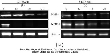 Anti-MMP9 antibody [N2C1], Internal used in Western Blot (WB). GTX100458