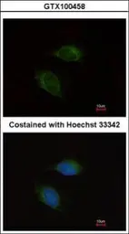 Anti-MMP9 antibody [N2C1], Internal used in Immunocytochemistry/ Immunofluorescence (ICC/IF). GTX100458