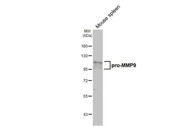 Anti-MMP9 antibody [N2C1], Internal used in Western Blot (WB). GTX100458