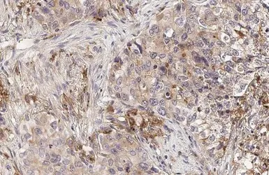 Anti-uPAR antibody used in IHC (Paraffin sections) (IHC-P). GTX100467