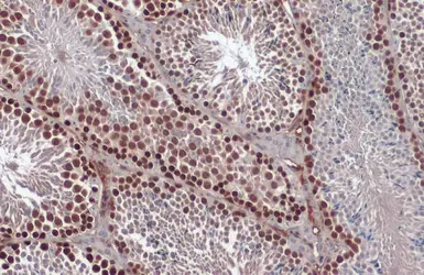 Anti-Rad51 antibody [N1C2] used in IHC (Paraffin sections) (IHC-P). GTX100469