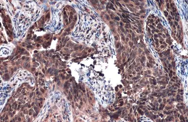 Anti-Rad51 antibody [N1C2] used in IHC (Paraffin sections) (IHC-P). GTX100469