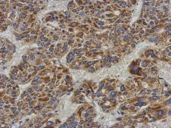 Anti-ACADL antibody [N1N2], N-term used in IHC (Paraffin sections) (IHC-P). GTX100486