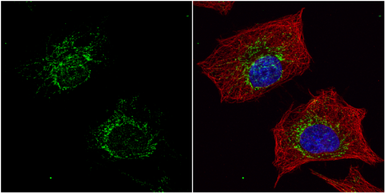 Anti-ACADM antibody used in Immunocytochemistry/ Immunofluorescence (ICC/IF). GTX100488