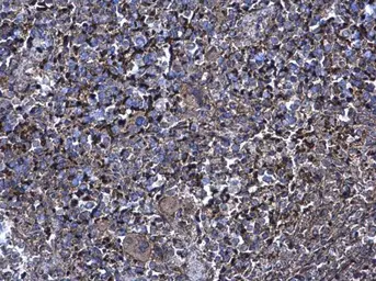 Anti-XIAP antibody [C1C3] used in IHC (Paraffin sections) (IHC-P). GTX100496