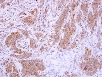 Anti-XIAP antibody [C1C3] used in IHC (Paraffin sections) (IHC-P). GTX100496