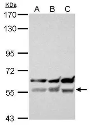 Anti-XIAP antibody [C1C3] used in Western Blot (WB). GTX100496