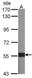 Anti-XIAP antibody [C1C3] used in Western Blot (WB). GTX100496