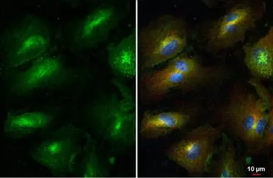 Anti-MMP1 antibody used in Immunocytochemistry/ Immunofluorescence (ICC/IF). GTX100534