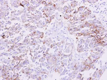 Anti-NDRG1 antibody used in IHC (Paraffin sections) (IHC-P). GTX100537