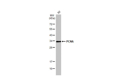 Anti-PCNA antibody used in Western Blot (WB). GTX100539