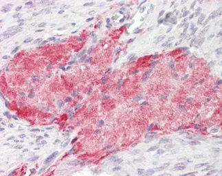 Anti-Tenascin C antibody [C3], C-term used in IHC (Paraffin sections) (IHC-P). GTX100558