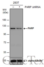 Anti-PARP antibody used in Western Blot (WB). GTX100573