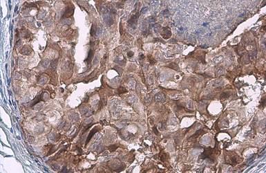 Anti-FADD antibody used in IHC (Paraffin sections) (IHC-P). GTX100612