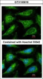 Anti-c-Yes antibody used in Immunocytochemistry/ Immunofluorescence (ICC/IF). GTX100616