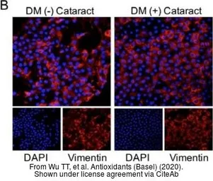 Anti-Vimentin antibody used in (). GTX100619