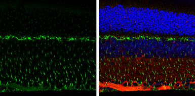 Anti-Vimentin antibody used in IHC (Paraffin sections) (IHC-P). GTX100619