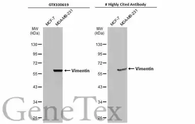 Anti-Vimentin antibody used in Western Blot (WB). GTX100619