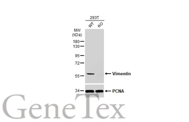Anti-Vimentin antibody used in Western Blot (WB). GTX100619