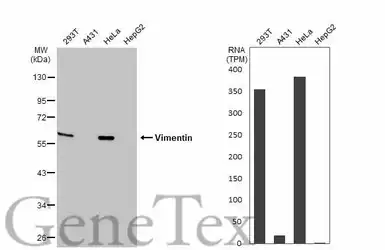 Anti-Vimentin antibody used in Western Blot (WB). GTX100619