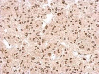 Anti-p53 antibody [N1], N-term used in IHC (Paraffin sections) (IHC-P). GTX100629