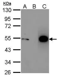 Anti-p53 antibody [N1], N-term used in Immunoprecipitation (IP). GTX100629
